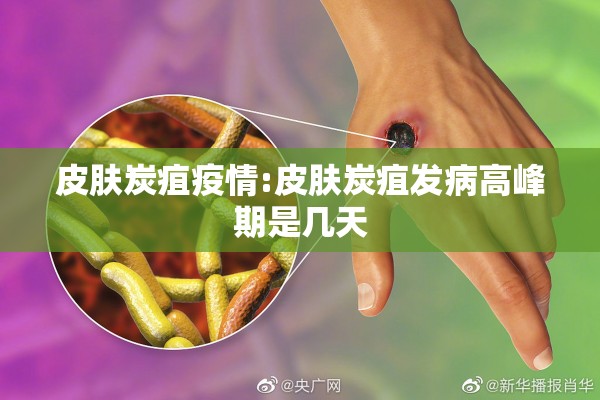 皮肤炭疽疫情:皮肤炭疽发病高峰期是几天