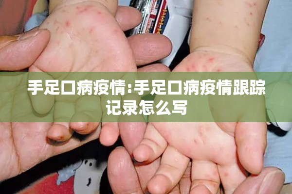 手足口病疫情:手足口病疫情跟踪记录怎么写