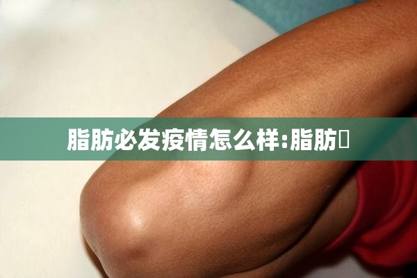 脂肪必发疫情怎么样:脂肪腫